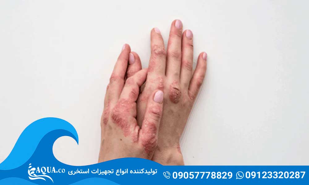 بیماری های پوستی در استخر